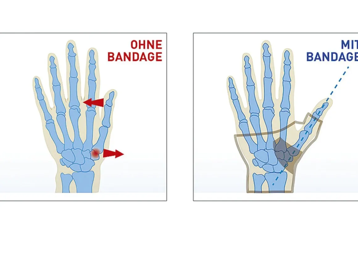 "epitact" Daumenbandage